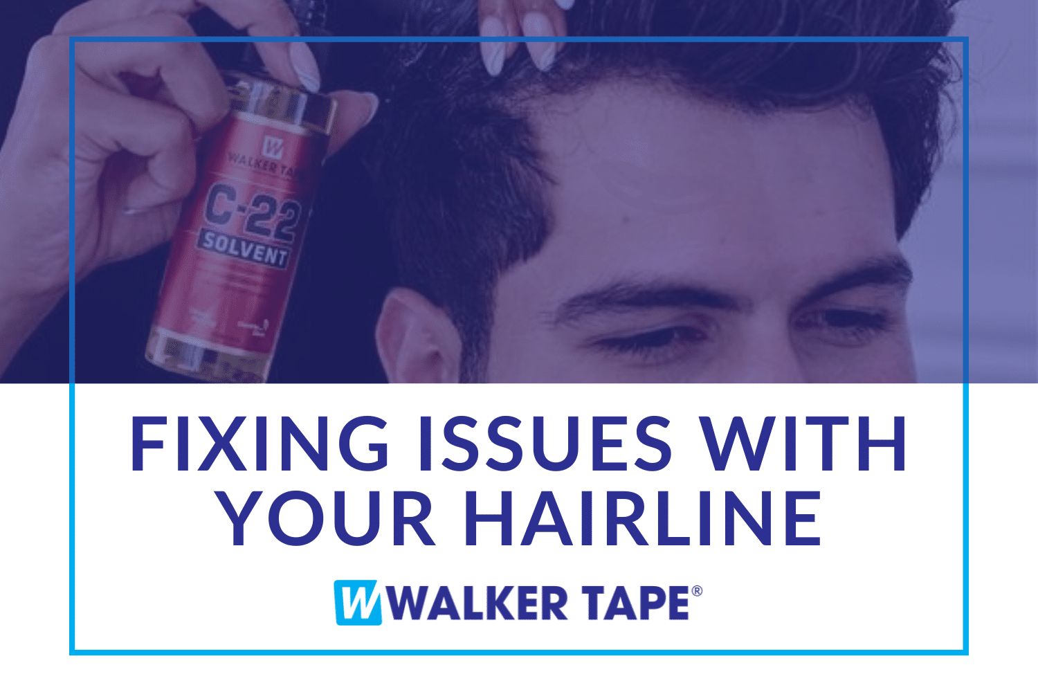 Fixing issues with your hairline - header graphic