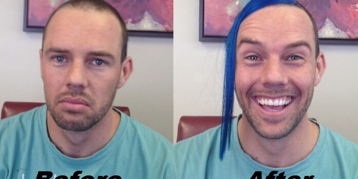 Before-after-shane