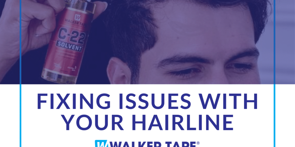 Fixing issues with your hairline - header graphic